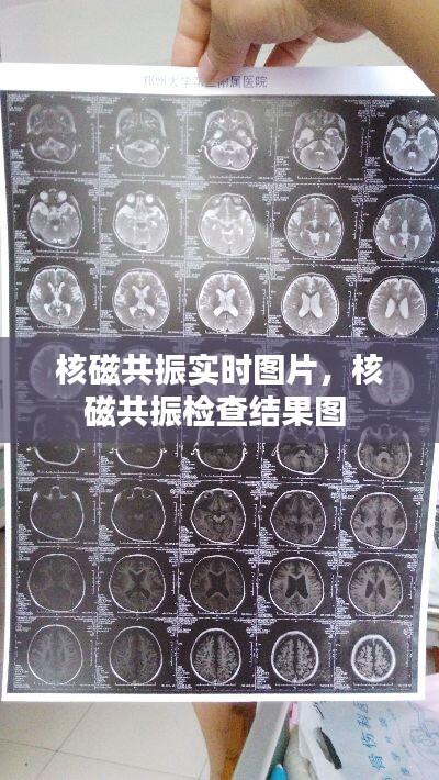 核磁共振实时图片,核磁共振检查结果图