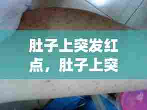 肚子上突发红点,肚子上突然长红点不痒不痛