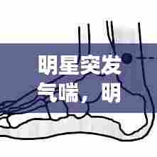 明星突发气喘，明星得哮喘的有哪些 