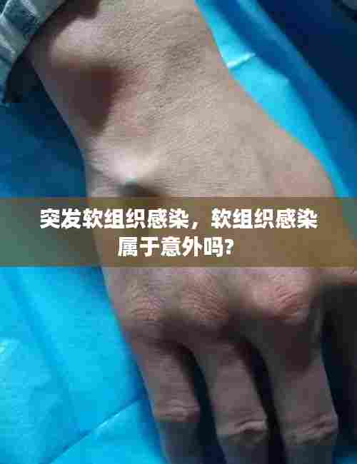 突发软组织感染,软组织感染属于意外吗?