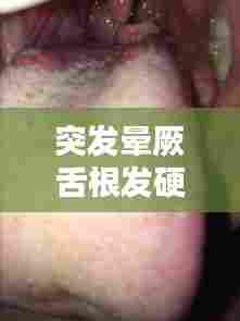 突发晕厥舌根发硬,晕倒后舌头伸出来发紫