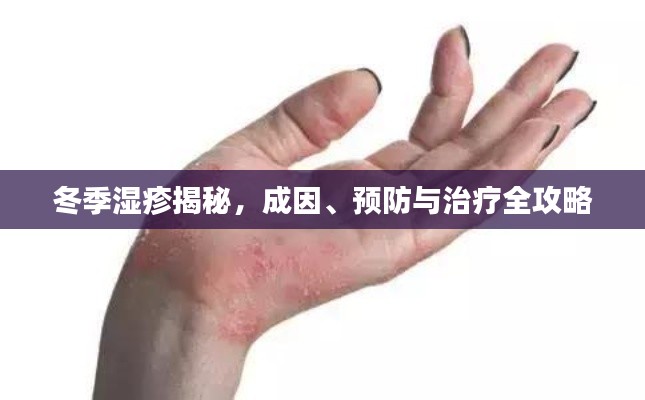冬季湿疹揭秘,成因、预防与治疗全攻略