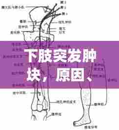下肢突发肿块,原因、诊断及有效治疗策略