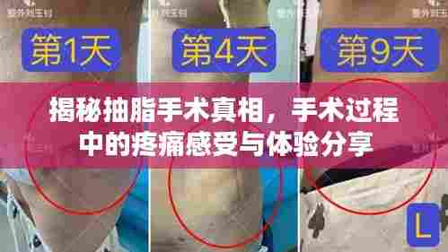 揭秘抽脂手术真相,手术过程中的疼痛感受与体验分享